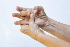 Diabeteshanden drabbas oftare av triggerfinger