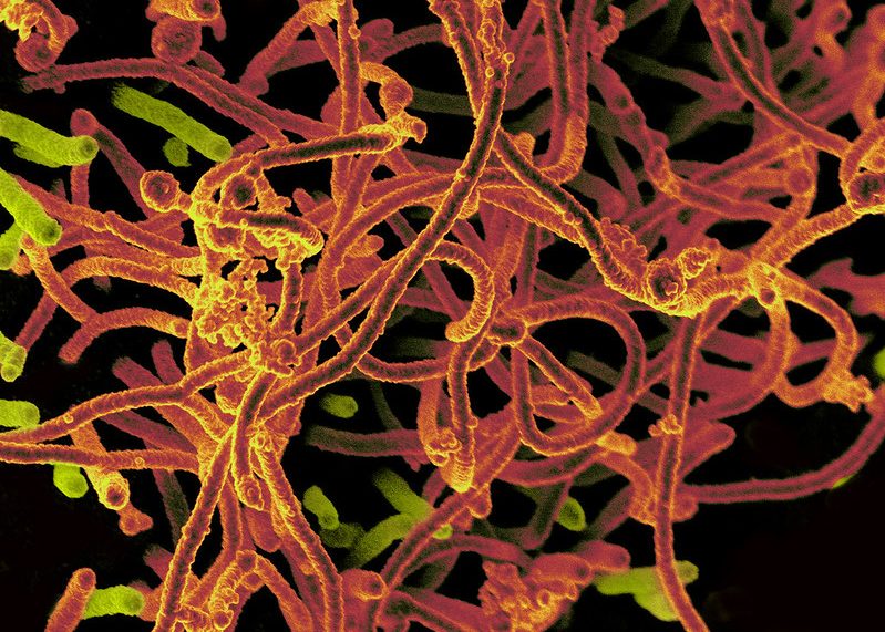 Mikroskopibild av maskliknande strukturer som föreställer ebolaviruset