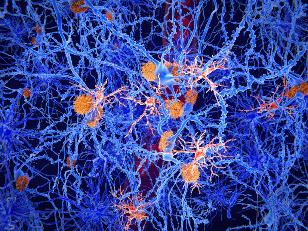 illustration av nervceller och mikroglia