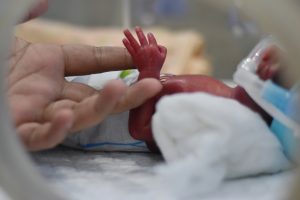 Milda stimulerande medel förbättrar prematura barns utveckling