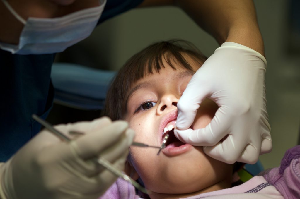 Ansikte på flicka som ligger i tandläkarstol. Tandläkaren som undersöker barnet har handskbeklädda händer och munskydd. Syns inte i helbild, bara händer och del av ansikte