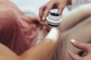 Malignt melanom – återfall efter immunterapi