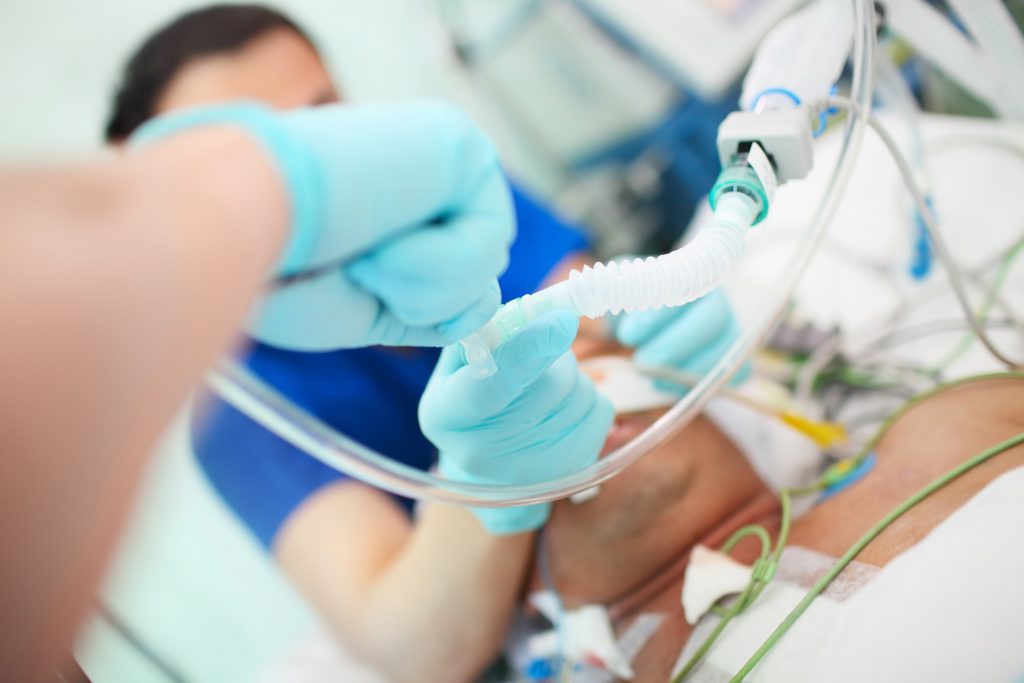 Bild från iva med närbild på respiratorslang