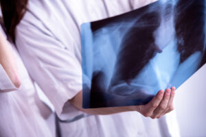 Oklar andfåddhet får snabbare diagnos med hjälp av blodproteiner